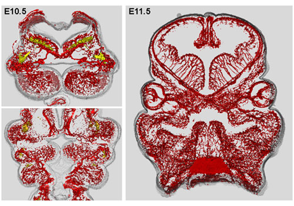 Work A2-3 マウス顔面形成時の神経・血管網の構築