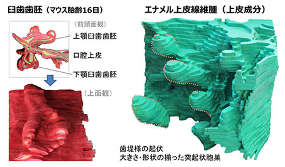 Work B3-h25 エナメル上皮線維腫の組織構造