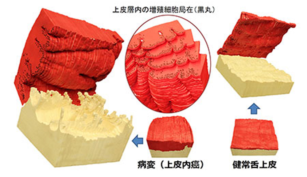 Work B3-h26 粘膜病変における構造変化